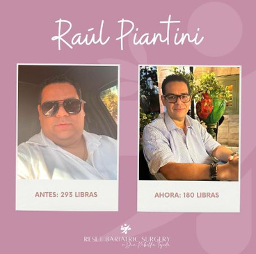 Slider image (6) Reset Bariatric Surgery